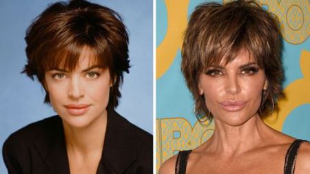 صور فنانات قبل وبعد عمليات التجميل.. النتيجة صادمة!